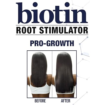 Difeel Biotin Leave-In Root Stimulator 7.1oz - Elevate Styles