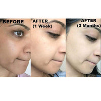 Thumbnail for Kojie San Skin Lightening Kojic Acid Soap – Classic